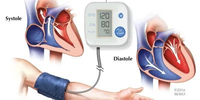 blood-pressure-measurement